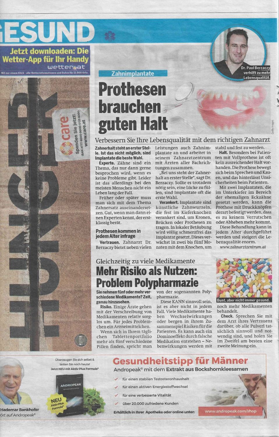 Zahnimplantate, Prothesen brauchen guten Halt